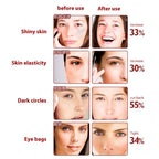 ✨ Activa Tu Mirada en Minutos — Masajeador Rejuvenecedor para Ojos y Rostro <br> <span style="color:#dc2626;font-weight:900;">🔥 OFERTA ESPECIAL: 25% DE DESCUENTO</span>