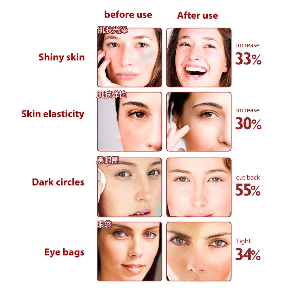 ✨ Activa Tu Mirada en Minutos — Masajeador Rejuvenecedor para Ojos y Rostro <br> <span style="color:#dc2626;font-weight:900;">🔥 OFERTA ESPECIAL: 25% DE DESCUENTO</span>