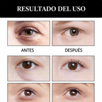 👀 El secreto del Veneno de Serpiente para una mirada más fresca, hidratada y descansada <br> <span style="color:#dc2626;font-weight:900;">🔥 OFERTA ESPECIAL: 25% DE DESCUENTO</span>