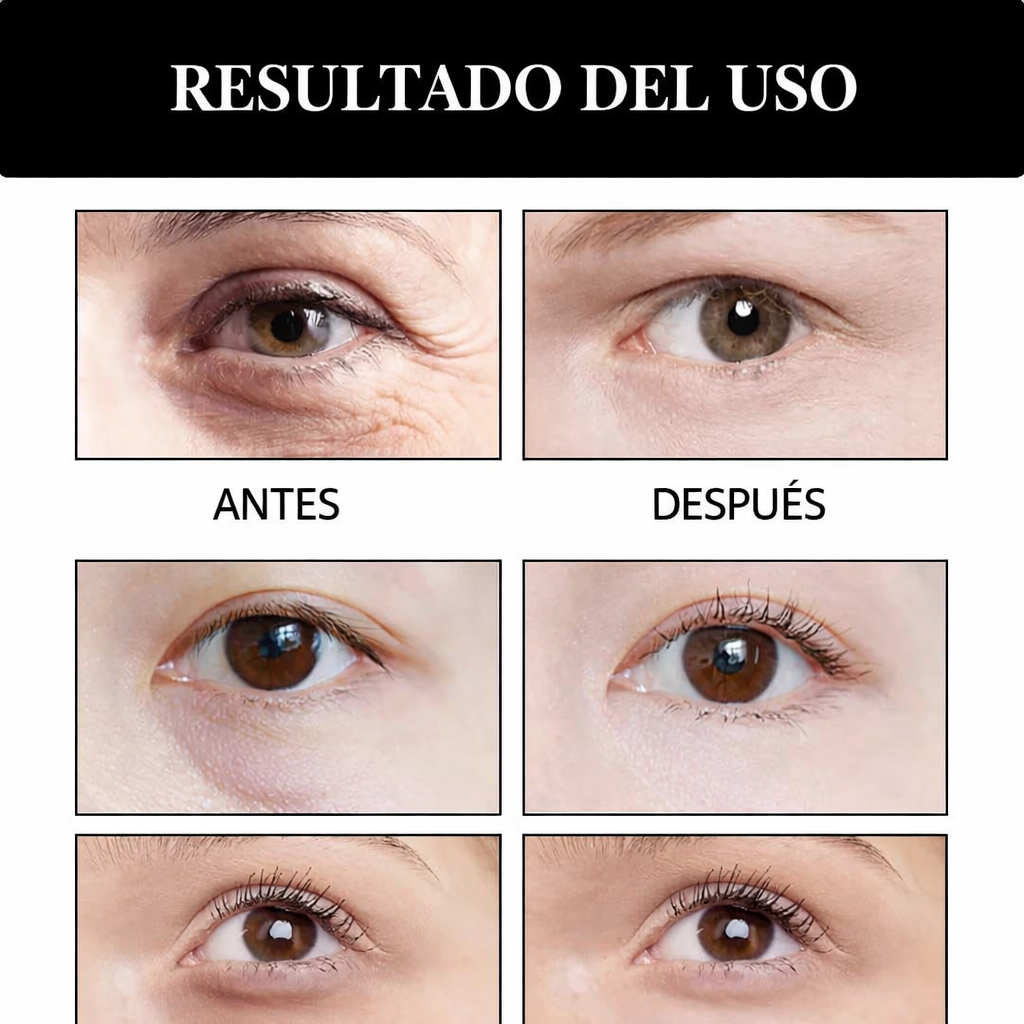 👀 El secreto del Veneno de Serpiente para una mirada más fresca, hidratada y descansada <br> <span style="color:#dc2626;font-weight:900;">🔥 OFERTA ESPECIAL: 25% DE DESCUENTO</span>
