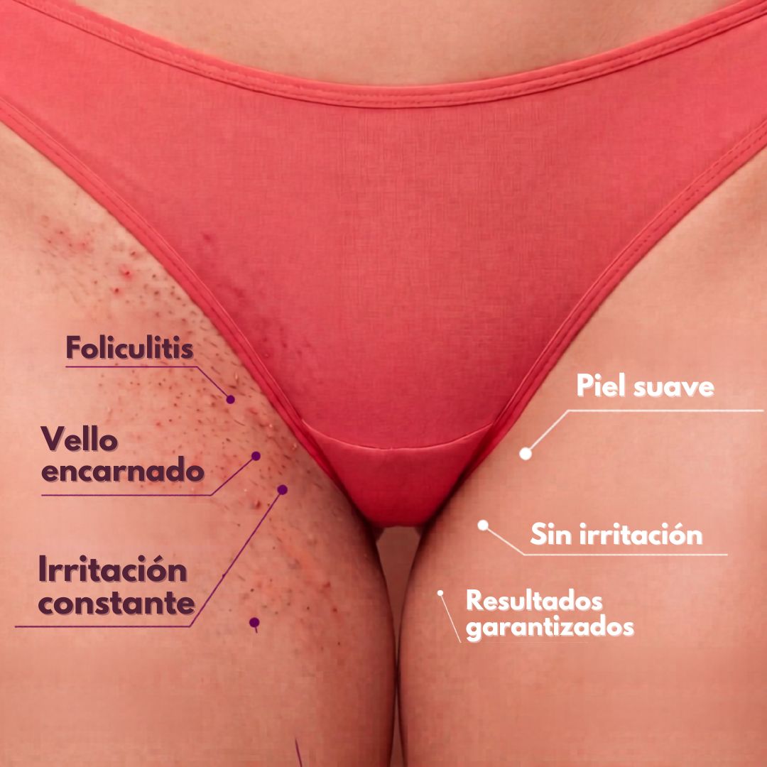 Menos vello. Sin dolor. Sin láser.
