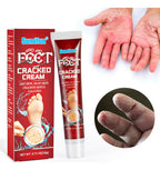 🧴✨ SUMIFUN Cracked Cream — Manos y Talones Súper Suaves Todos los Días 👣🤲<br> <span style="color:#dc2626;font-weight:900;">🔥 OFERTA ESPECIAL: 25% DE DESCUENTO</span>