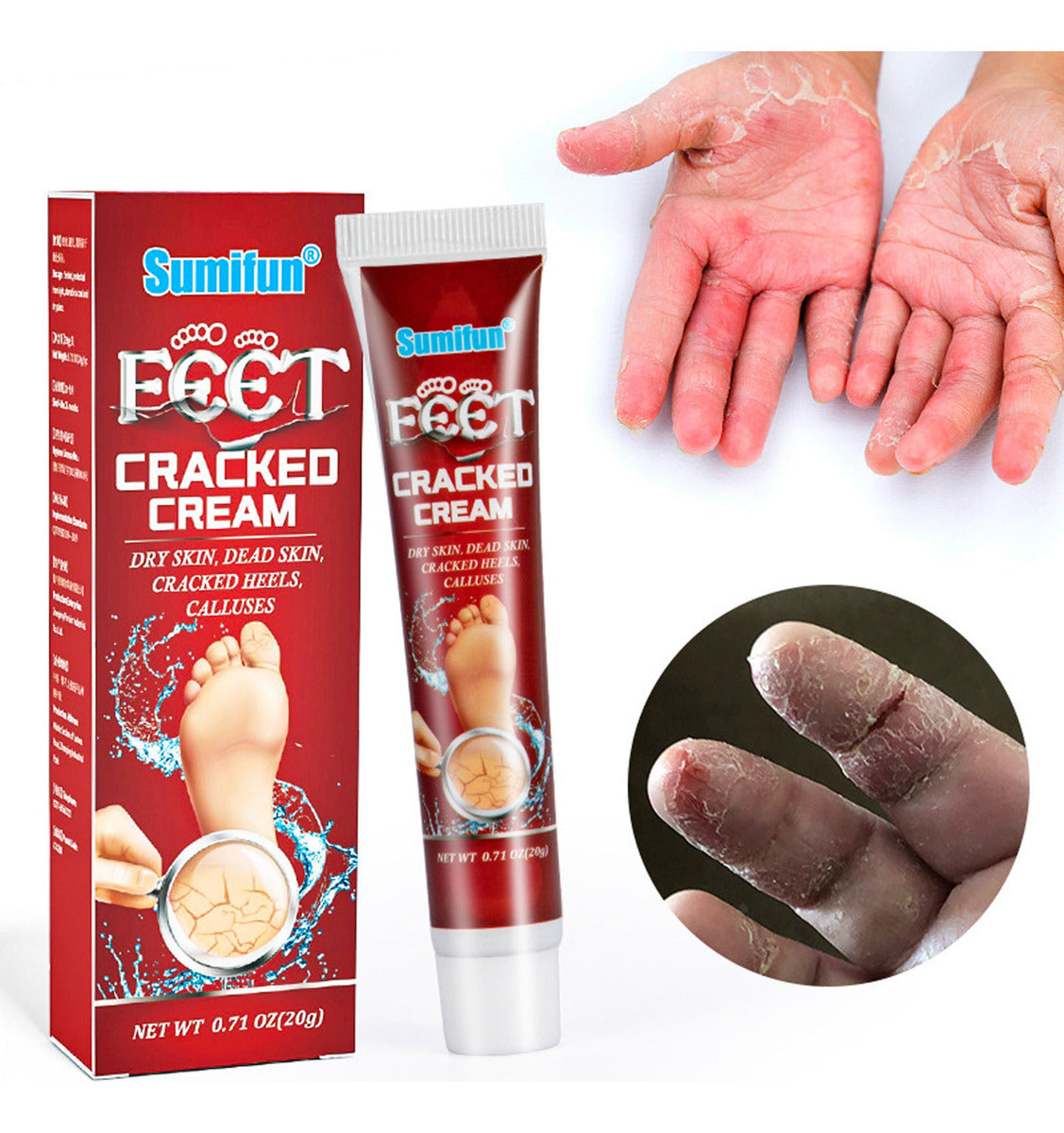 🧴✨ SUMIFUN Cracked Cream — Manos y Talones Súper Suaves Todos los Días 👣🤲<br> <span style="color:#dc2626;font-weight:900;">🔥 OFERTA ESPECIAL: 25% DE DESCUENTO</span>