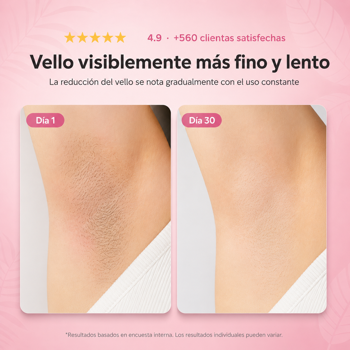 Menos vello. Sin dolor. Sin láser.
