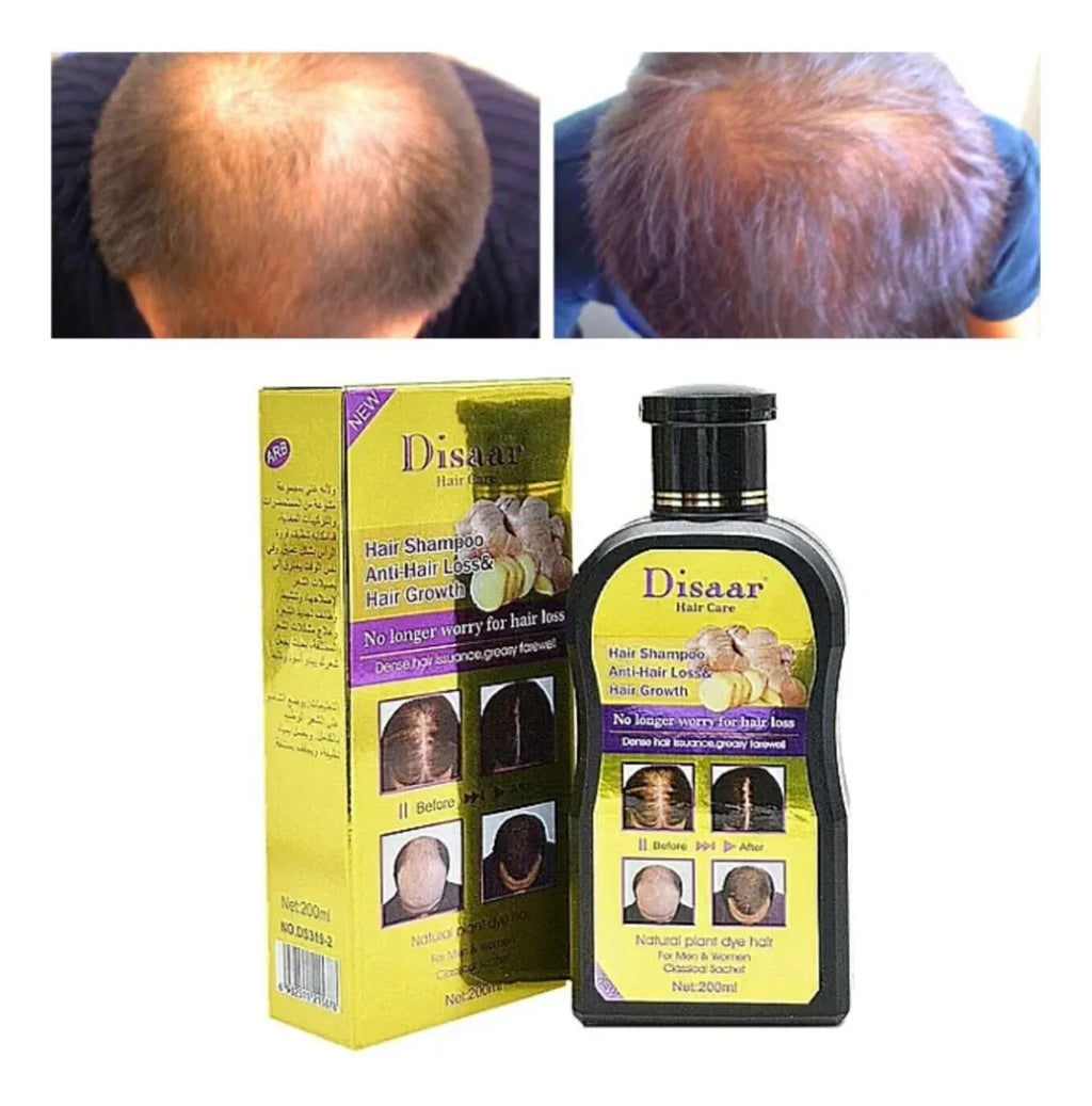 😱 Se Te Cae el Cabello? Disaar Lo Frena y Lo Hace Crecer – 200 ml🚨<br> <span style="color:#dc2626;font-weight:900;">🔥 OFERTA ESPECIAL: 25% DE DESCUENTO</span>