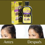 😱 Se Te Cae el Cabello? Disaar Lo Frena y Lo Hace Crecer – 200 ml🚨<br> <span style="color:#dc2626;font-weight:900;">🔥 OFERTA ESPECIAL: 25% DE DESCUENTO</span>