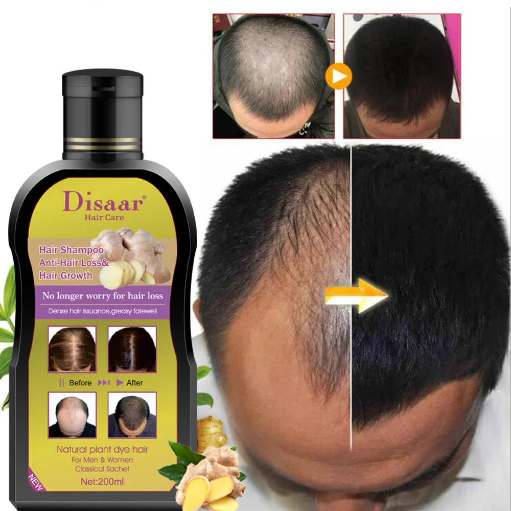 😱 Se Te Cae el Cabello? Disaar Lo Frena y Lo Hace Crecer – 200 ml🚨<br> <span style="color:#dc2626;font-weight:900;">🔥 OFERTA ESPECIAL: 25% DE DESCUENTO</span>