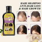 😱 Se Te Cae el Cabello? Disaar Lo Frena y Lo Hace Crecer – 200 ml🚨<br> <span style="color:#dc2626;font-weight:900;">🔥 OFERTA ESPECIAL: 25% DE DESCUENTO</span>