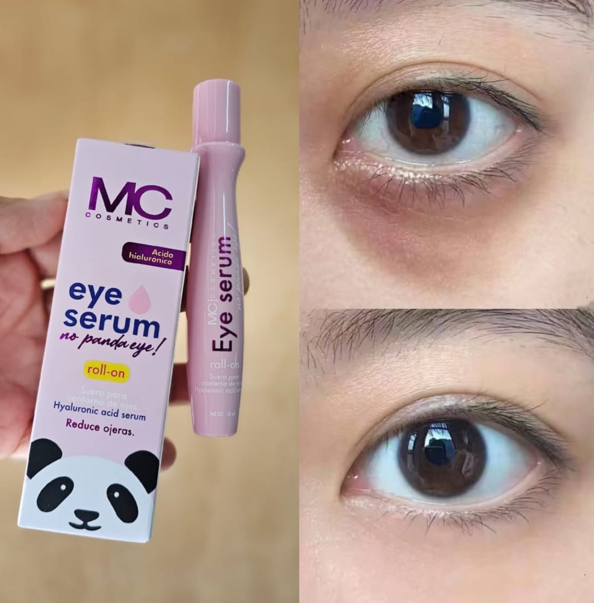 Serum Roll-On Mirada Sana – Ojos Frescos, Hidratados y Luminosos ✨ <br> <span style="color:#dc2626;font-weight:900;">🔥 OFERTA ESPECIAL: 25% DE DESCUENTO</span>