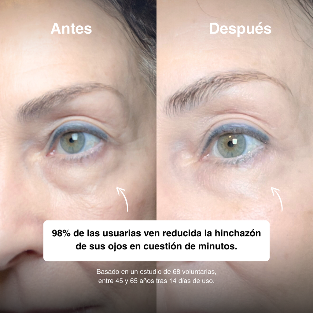 Serum Roll-On Mirada Sana – Ojos Frescos, Hidratados y Luminosos ✨ <br> <span style="color:#dc2626;font-weight:900;">🔥 OFERTA ESPECIAL: 25% DE DESCUENTO</span>