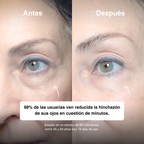 Serum Roll-On Mirada Sana – Ojos Frescos, Hidratados y Luminosos ✨ <br> <span style="color:#dc2626;font-weight:900;">🔥 OFERTA ESPECIAL: 25% DE DESCUENTO</span>