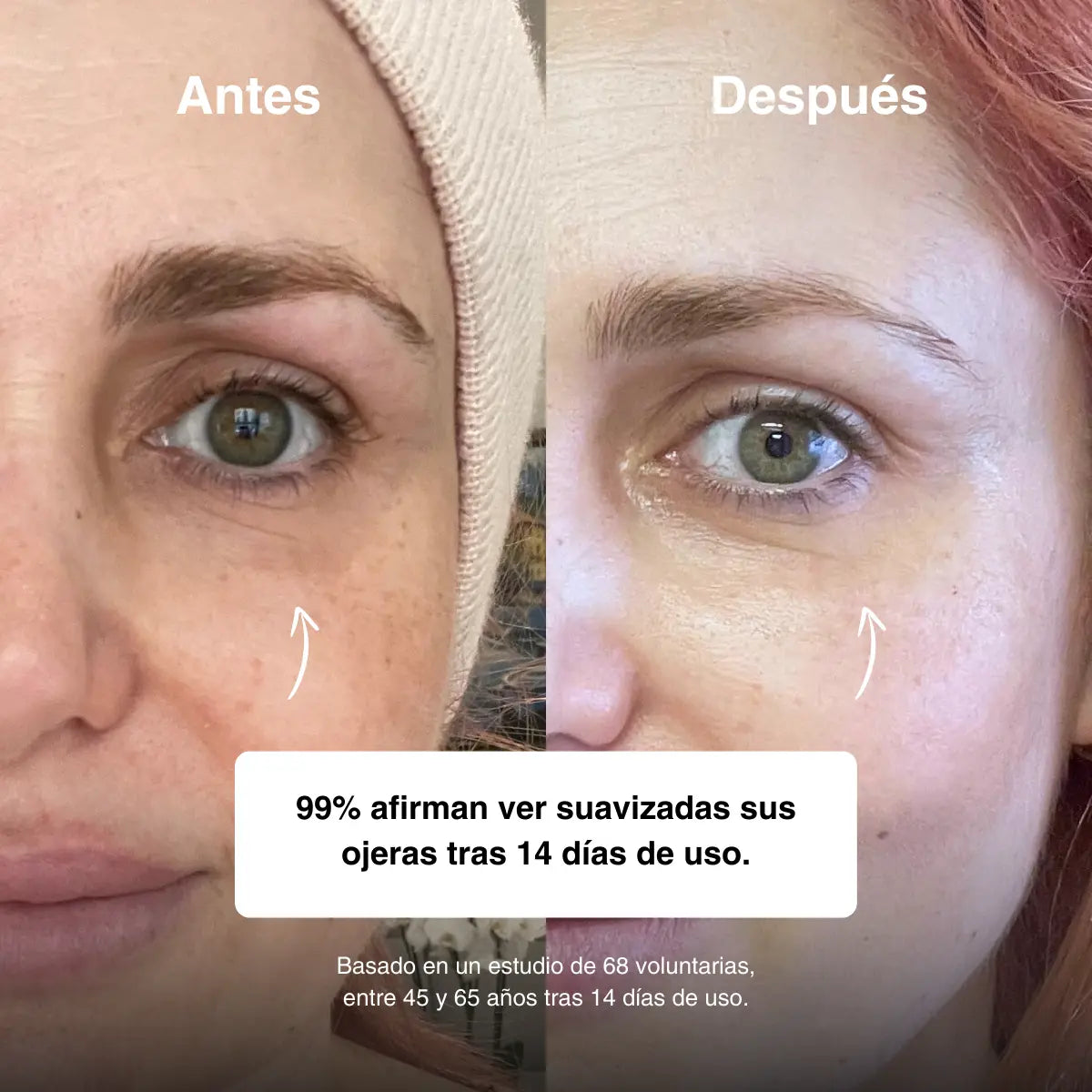 Serum Roll-On Mirada Sana – Ojos Frescos, Hidratados y Luminosos ✨ <br> <span style="color:#dc2626;font-weight:900;">🔥 OFERTA ESPECIAL: 25% DE DESCUENTO</span>